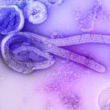 Microscopic image of Marburg Virus