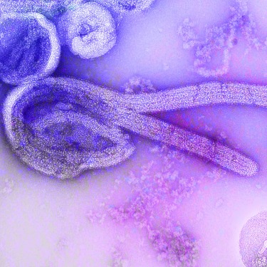 Microscopic image of Marburg Virus